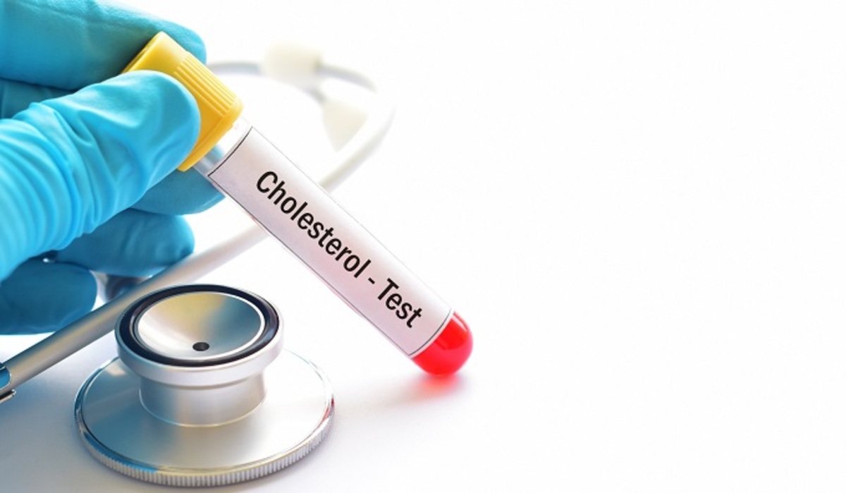 Питание и холестерин: мифы и правда