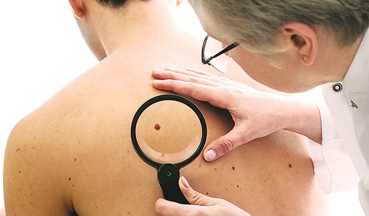 Влияние солнечных лучей на функцию репродуктивной системы мужчин