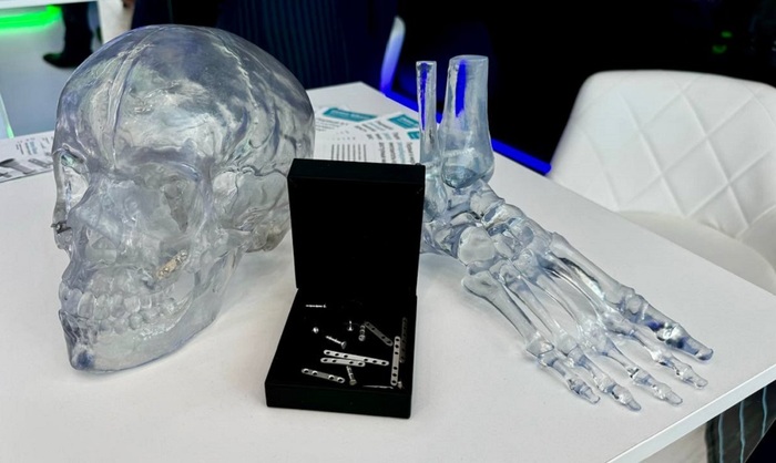 Созданы «растворимые» импланты для костей - фото