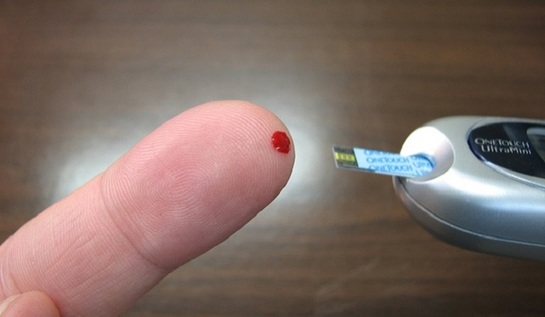Большинство россиян не знают свой уровень сахара в крови — исследование - фото