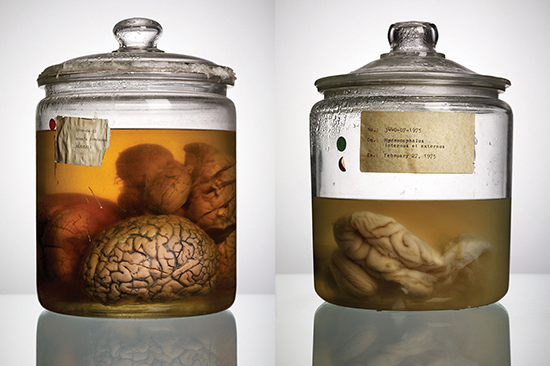 Шок: в Техасе открылся музей человеческих мозгов