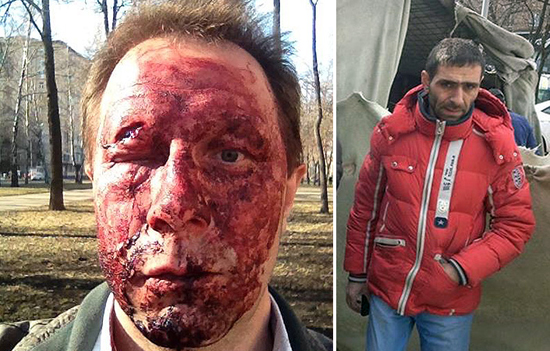 В Москве избит муниципальный депутат от Справедливой России Сергей Дорофеев
