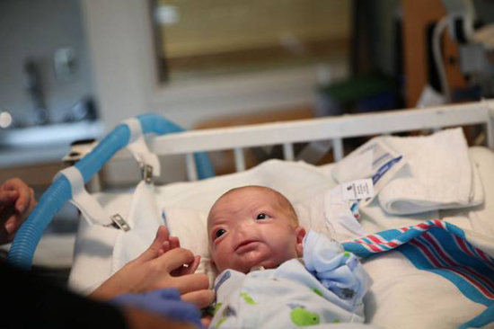 Ужас: в США родился уникальный ребенок без носа